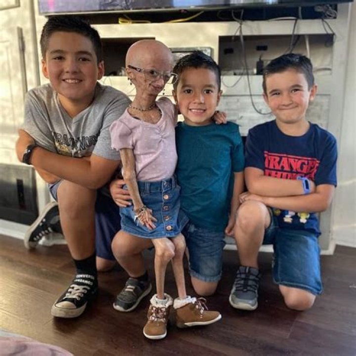 Adalia Rose Father Ryan Pallante And Mother Natalie Pallante – Are They Her Biological Parents?