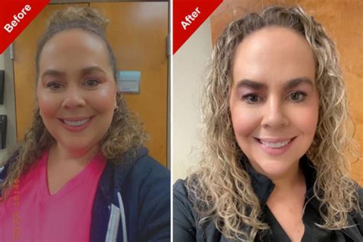 Danielle Macdonald Weight Loss Pictures – Before and After