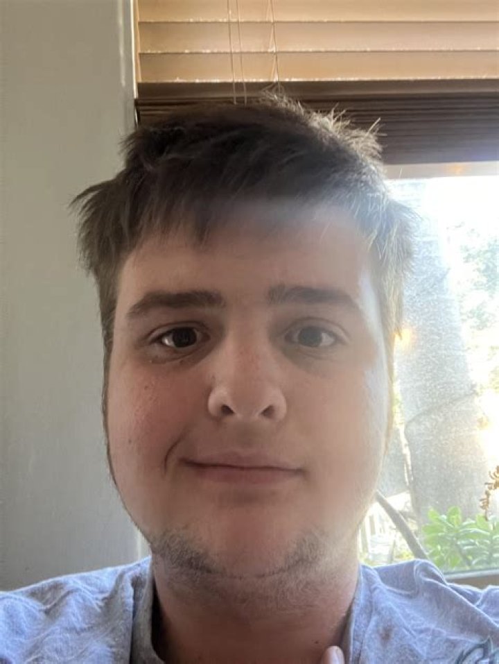 Has Skurry Done A Face Reveal? What Is The Real Name Of Twitch Star