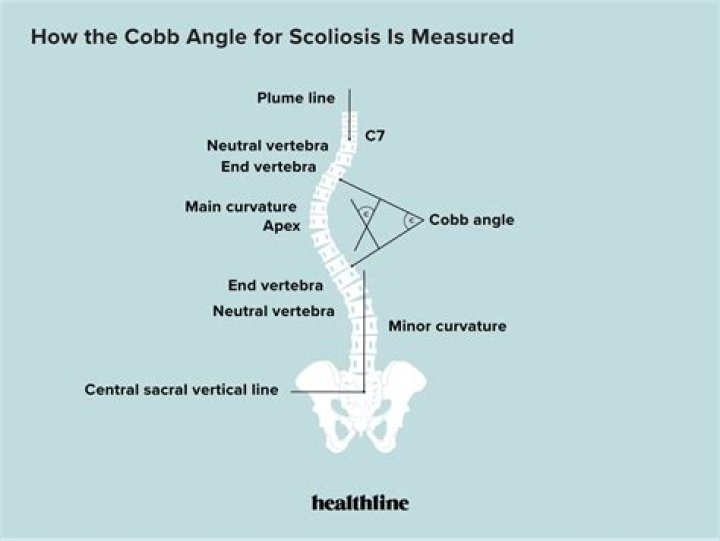 Is Alex Cobb Related To Ty Cobb? Relationship Explained
