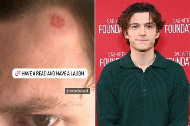 What Happened To Tom Guiry Face, Did The Actor Have Stroke?- What’s Wrong?